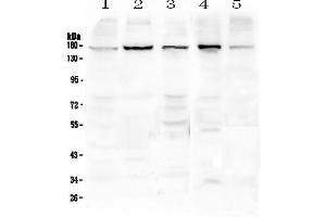 Western blot analysis of EEA1 using anti-EEA1 antibody .