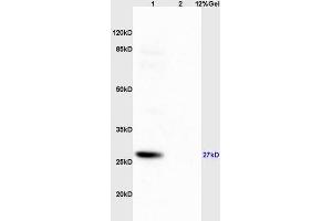 Lane 1: mouse brain lysates Lane 2: mouse pancreas lysates probed with Anti Phospho-S6 Ribosomal Protein (Ser235+Ser236) Polyclonal Antibody, Unconjugated (ABIN745583) at 1:200 in 4 °C.