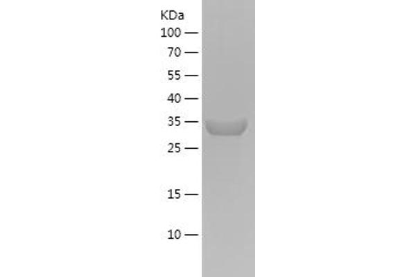 Actin Protein (AA 81-140) (His-IF2DI Tag)