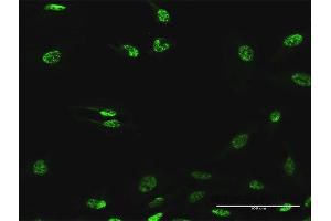 Immunofluorescence of purified MaxPab antibody to SF3B2 on HeLa cell. (SF3B2 antibody  (AA 1-636))