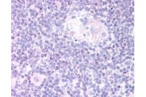ABIN185069 (20µg/ml) staining of paraffin embedded Human Thymus Medulla. (FOXN1 antibody  (C-Term))