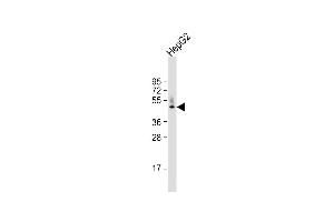 Anti-HPD Antibody (N-term) at 1:1000 dilution + HepG2 whole cell lysate Lysates/proteins at 20 μg per lane. (HPD antibody  (N-Term))