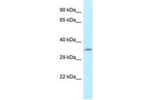 Image no. 1 for anti-Fumarylacetoacetate Hydrolase Domain Containing 2A (FAHD2A) (AA 28-77) antibody (ABIN6747792) (FAHD2A antibody  (AA 28-77))