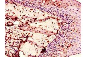 Immunohistochemistry of paraffin-embedded human tonsil tissue using ABIN7151381 at dilution of 1:100 (ENTPD8 antibody  (AA 30-434))
