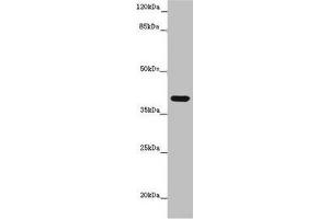 Western blot All lanes: MR1 antibody at 6 μg/mL + K562 whole cell lysate Secondary Goat polyclonal to rabbit IgG at 1/10000 dilution Predicted band size: 40, 35, 29, 26 kDa Observed band size: 40 kDa (MR1 antibody  (AA 150-253))