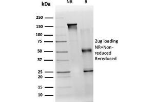 SDS-PAGE Analysis Purified TDRKH Mouse Monoclonal Antibody (PCRP-TDRKH-1H2).