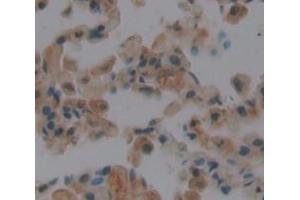 Used in DAB staining on fromalin fixed paraffin- embedded Kidney tissue (Endothelin 2 antibody  (AA 32-178))
