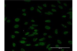 Immunofluorescence of monoclonal antibody to LSM6 on HeLa cell. (LSM6 antibody  (AA 1-80))