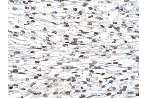 Immunohistochemistry (IHC) image for anti-Hes Family bHLH Transcription Factor 1 (HES1) (N-Term) antibody (ABIN2779597)