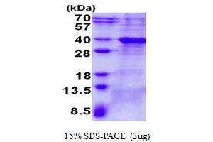 Image no. 1 for B-Cell CLL/lymphoma 7A (BCL7A) protein (His tag) (ABIN1098485)