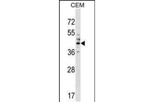 Western blot analysis in CEM cell line lysates (35ug/lane). (CEACAM6 antibody  (AA 188-214))