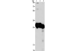 Western Blotting (WB) image for anti-Ketohexokinase (KHK) antibody (ABIN2429498) (Ketohexokinase antibody)