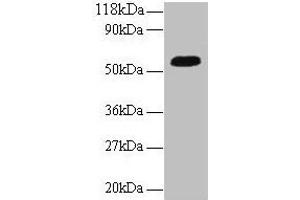 Western blot All lanes: ICA1 antibody at 2 μg/mL + A549 whole cell lysate Secondary Goat polyclonal to rabbit IgG at 1/10000 dilution Predicted band size: 55, 58 kDa Observed band size: 55 kDa