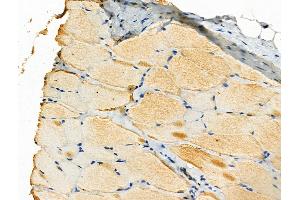 Phospho-SPHK2 (Ser387) Antibody at 1/100 staining Rat skin tissue by IHC-P.