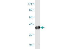 Western Blot detection against Immunogen (43. (PLA2G16 antibody  (AA 1-162))