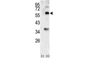 Western blot analysis of BMP3 antibody and 293 cell lysate (2 ug/lane) either nontransfected (Lane 1) or transiently transfected with the BMP3 gene (2). (BMP3 antibody  (AA 8-36))