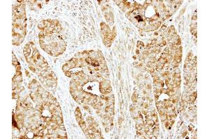 IHC-P Image Immunohistochemical analysis of paraffin-embedded NCI-N87 xenograft, using BBS10, antibody at 1:500 dilution. (BBS10 antibody)