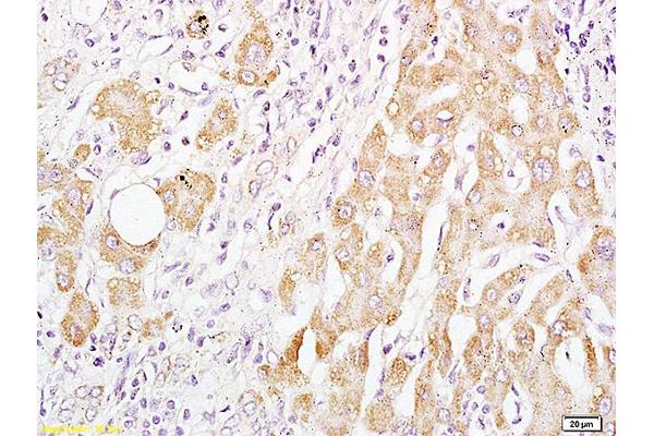 BAAT antibody  (AA 101-200)