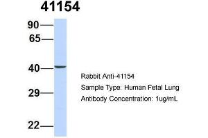 Host: Rabbit  Target Name: 41154  Sample Tissue: Human Fetal Lung  Antibody Dilution: 1.