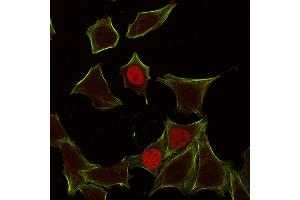 Immunofluorescence (IF) image for anti-Cyclin-Dependent Kinase Inhibitor 1A (p21, Cip1) (CDKN1A) antibody (ABIN6939037)