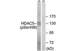 Western Blotting (WB) image for anti-Histone Deacetylase 5 (HDAC5) (pSer498) antibody (ABIN2888430) (HDAC5 antibody  (pSer498))