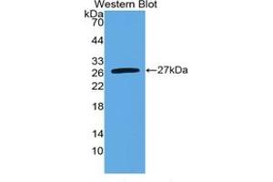 WB of Protein Standard: different control antibody against Highly purified E. (IL-6 ELISA Kit)