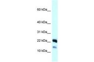 Image no. 1 for anti-NADH Dehydrogenase (Ubiquinone) 1 beta Subcomplex, 10, 22kDa (NDUFB10) (C-Term) antibody (ABIN6747916)