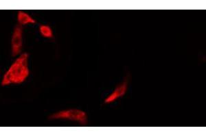 ABIN6274387 staining Hela cells by IF/ICC. (DAK antibody  (Internal Region))