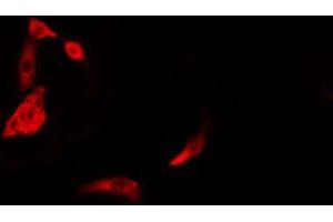 ABIN6274387 staining Hela cells by IF/ICC. (DAK antibody  (Internal Region))