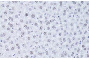 Immunohistochemistry of paraffin-embedded Mouse liver using CDKN1A Polyclonal Antibody at dilution of 1:100 (40x lens). (p21 antibody)