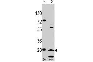 Western blot analysis of GRB2 (arrow) using rabbit GRB2 polyclonal antibody . (GRB2 antibody  (Tyr209))