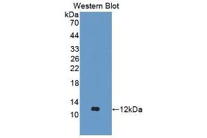 Western blot analysis of the recombinant protein. (Aggrecan antibody  (AA 587-684))