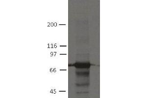 Image no. 1 for anti-Plakophilin 1 (PKP1) (AA 235-726) antibody (ABIN1169699) (Plakophilin 1 antibody  (AA 235-726))
