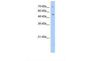 Image no. 1 for anti-Dihydropyrimidinase (DPYS) (AA 51-100) antibody (ABIN320643) (DPYS antibody  (AA 51-100))
