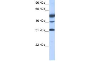 WB Suggested Anti-ATF1 Antibody Titration:  0. (AFT1 antibody  (C-Term))