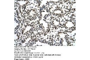 Human Lung (ZNF706 antibody  (N-Term))