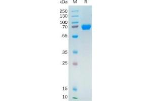 Human NRG1 Protein, hFc Tag on SDS-PAGE under reducing condition.