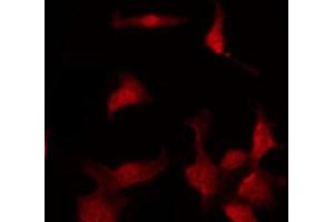 ABIN6267025 staining 293 by IF/ICC. (AKT1 antibody  (pThr308))