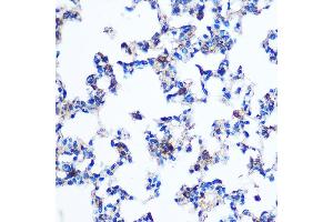 Immunohistochemistry of paraffin-embedded Rat lung using PKM2 Rabbit pAb (ABIN6128296, ABIN6145714, ABIN6145715 and ABIN6218076) at dilution of 1:100 (40x lens). (PKM antibody  (AA 11-221))