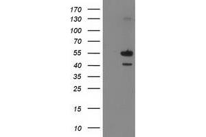 Image no. 1 for anti-Phosphatidylinositol-5-Phosphate 4-Kinase, Type II, alpha (PIP4K2A) antibody (ABIN1500226)