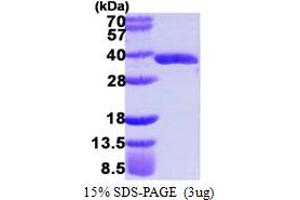 SDS-PAGE (SDS) image for Glyoxalase Domain Containing 4 (GLOD4) (AA 1-298) protein (His tag) (ABIN667509)