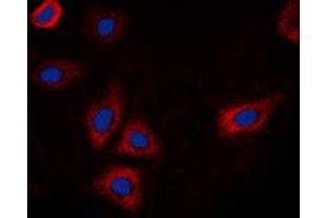 Immunofluorescent analysis of EGFR (pT693) staining in HEK293T cells. (EGFR antibody  (pSer693))