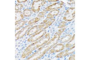 Immunohistochemistry of paraffin-embedded mouse kidney using TIRAP Rabbit mAb (ABIN7270842) at dilution of 1:100 (40x lens). (TIRAP antibody)