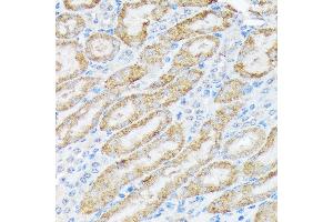 Immunohistochemistry of paraffin-embedded mouse kidney using TIRAP Rabbit mAb (ABIN7270842) at dilution of 1:100 (40x lens). (TIRAP antibody)