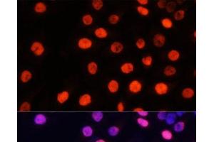 Immunofluorescence analysis of HeLa cells using MonoMethyl-NONO-R357/R365 Polyclonal Antibody at dilution of 1:100 (40x lens).