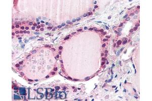ABIN185700 (5µg/ml) staining of paraffin embedded Human Thyroid. (FBXL3 antibody  (N-Term))