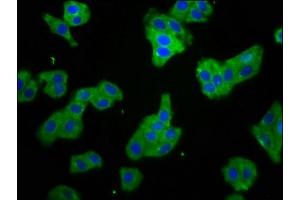 Immunofluorescence staining of HepG2 cells with ABIN7170553 at 1:66, counter-stained with DAPI. (SMPD2 antibody  (AA 199-301))