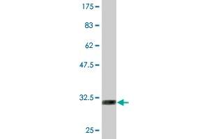 Western Blot detection against Immunogen (30. (GLUT4 antibody  (AA 467-509))