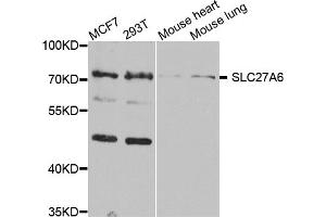 Western blot analysis of extracts of various cell lines, using SLC27A6 antibody (ABIN5974523) at 1/1000 dilution. (SLC27A6 antibody)