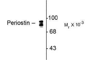 Image no. 1 for anti-Periostin (POSTN) antibody (ABIN372701) (Periostin antibody)